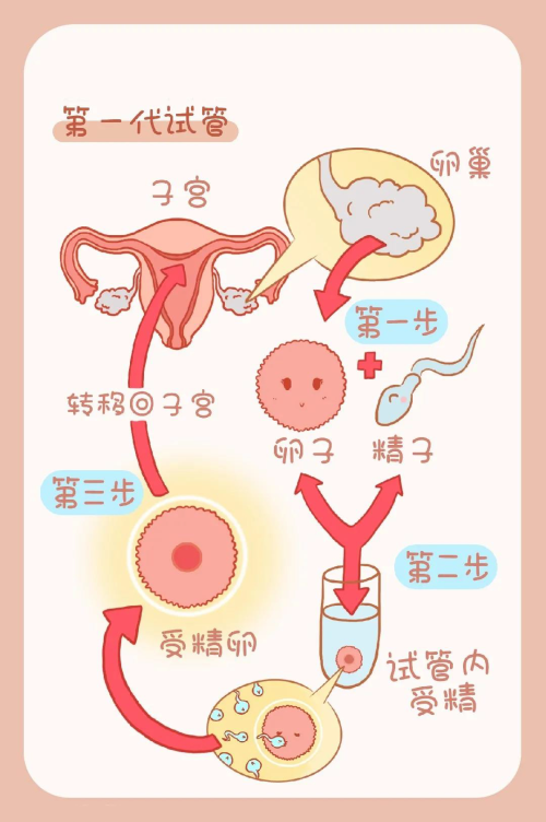 试管婴儿是怎么回事？详解技术、流程、风险及未来趋势