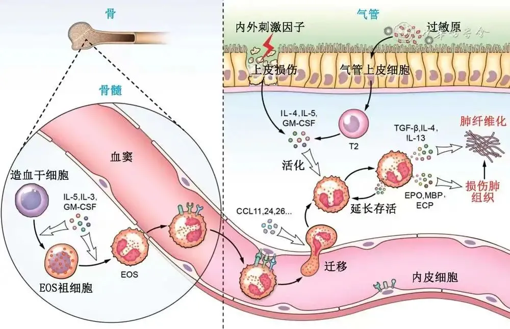 嗜酸性粒细胞高是怎么回事？深度解析及应对策略