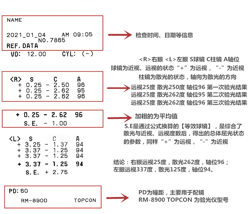 验光单怎么看？解读验光报告，助您轻松了解视力状况