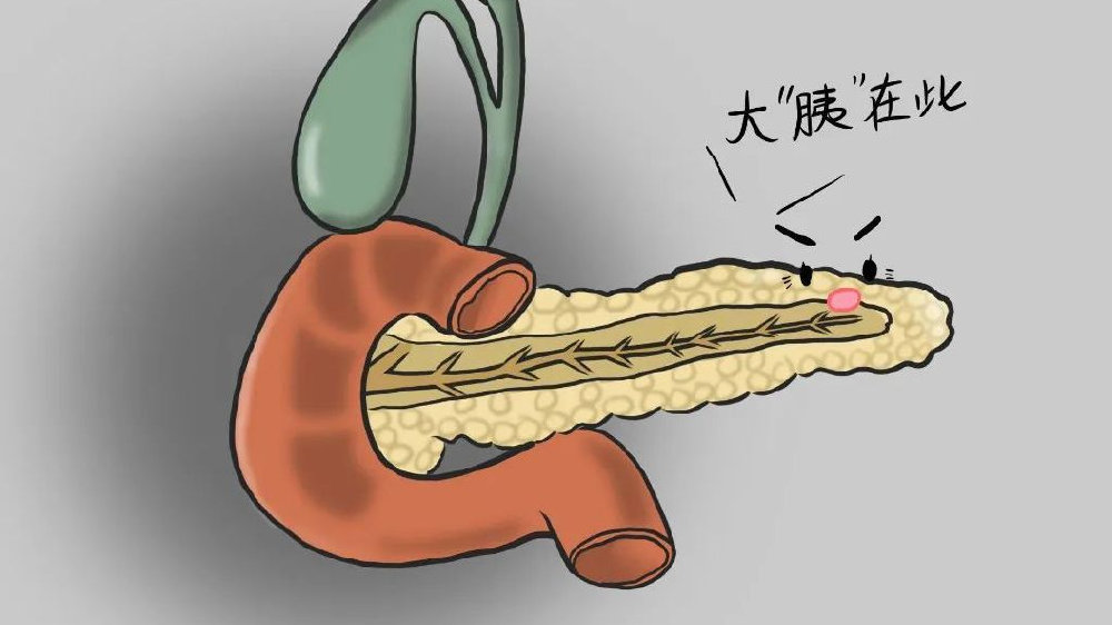 胰腺炎是怎么引起的？探究病因、风险及预防策略