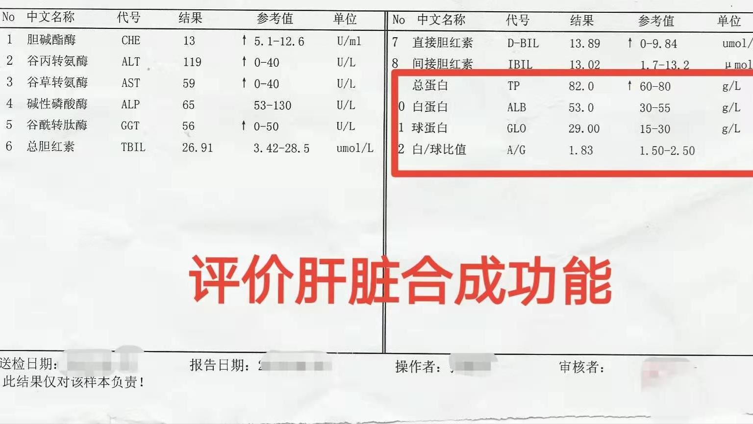 肝功五项化验单怎么看？解读报告，轻松掌握肝脏健康