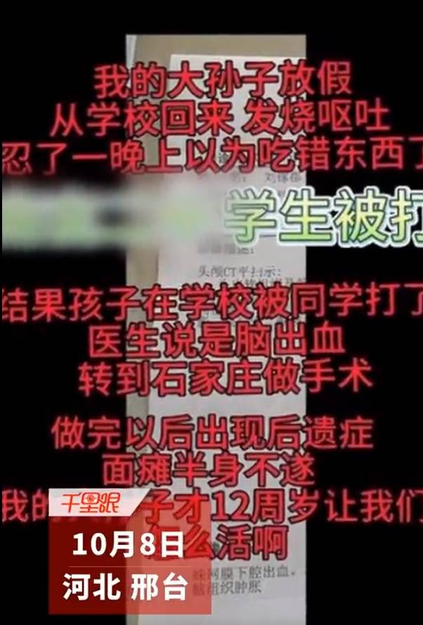 面瘫是怎么引起的？深度解析面瘫病因及预防措施