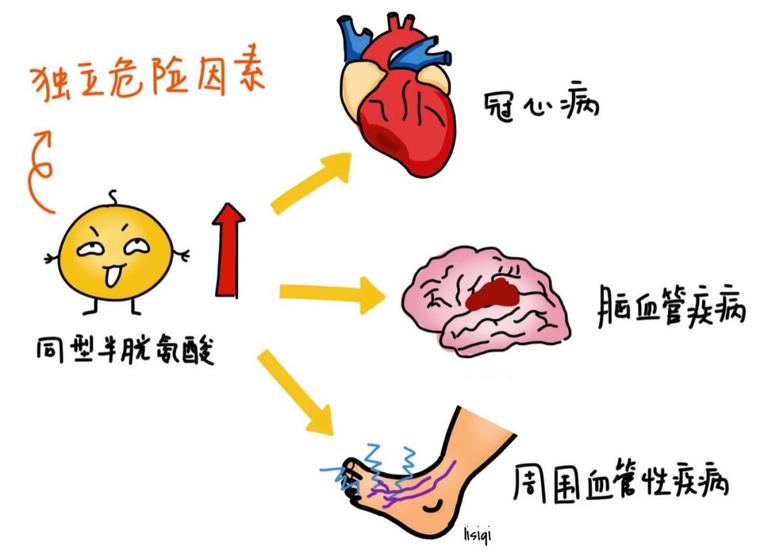 男性同型半胱氨酸高怎么治疗？权威解读及个性化方案