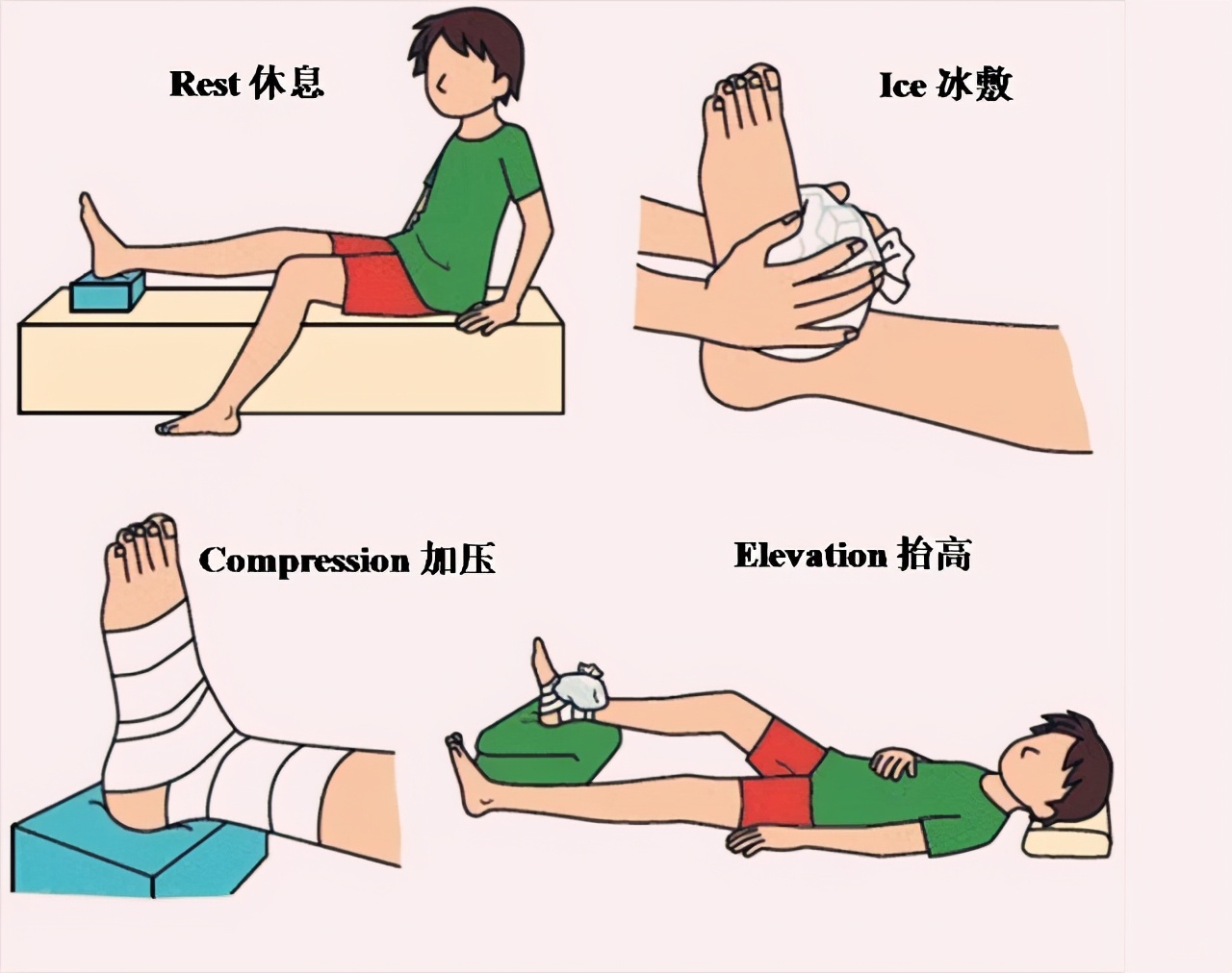 肌肉拉伤怎么办？实用指南助你快速恢复