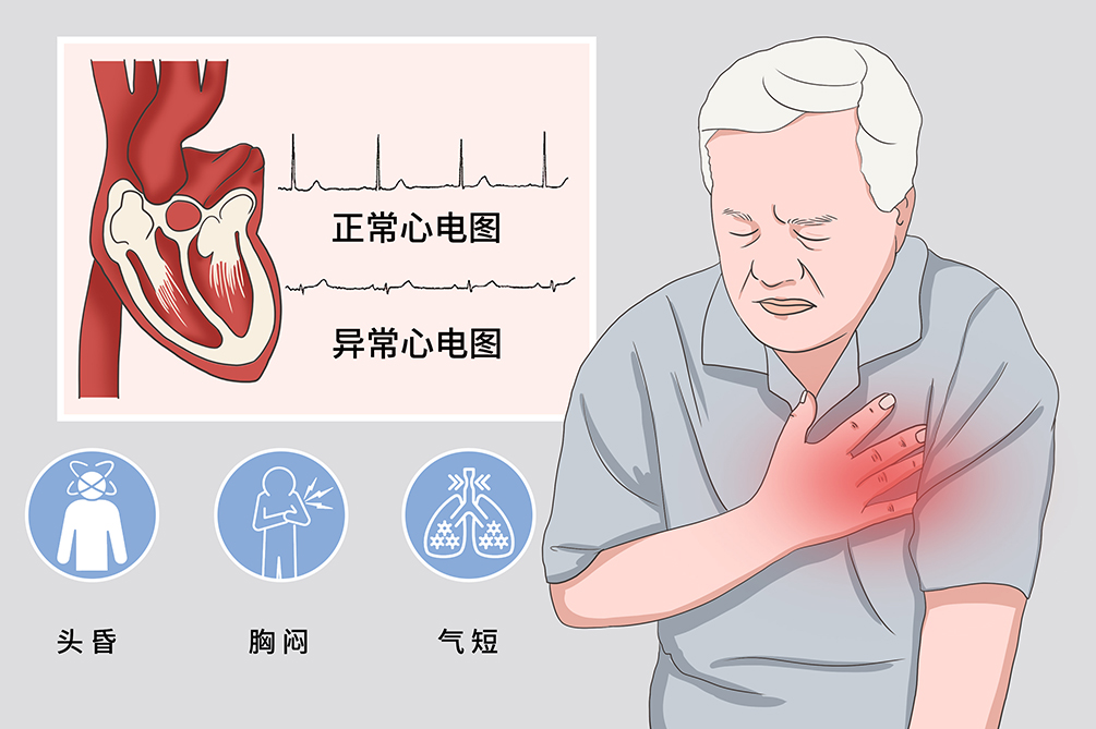 心跳过快怎么办怎么解决？专业解读及应对策略