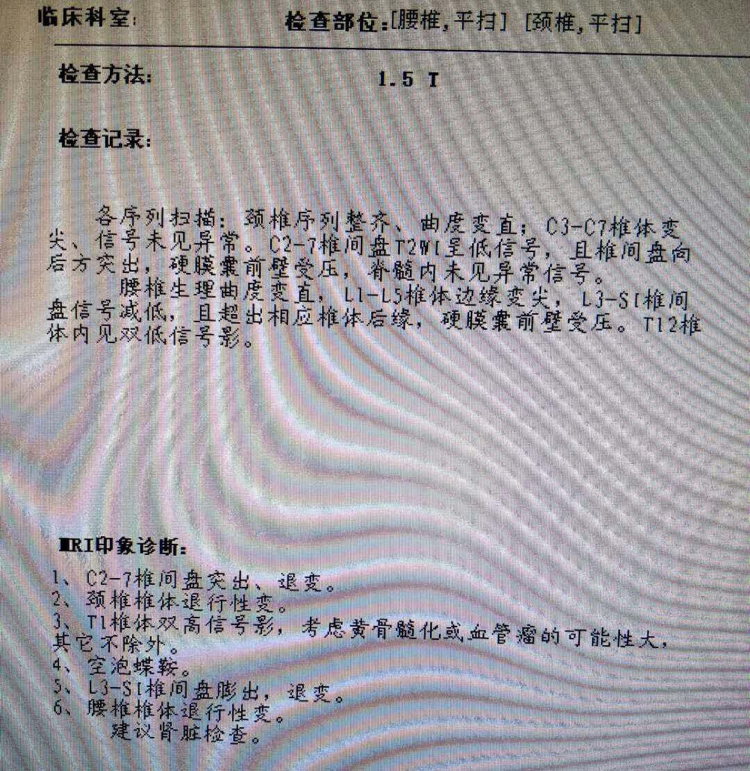 落枕脖子疼怎么办最快最有效？缓解疼痛的实用技巧与方法