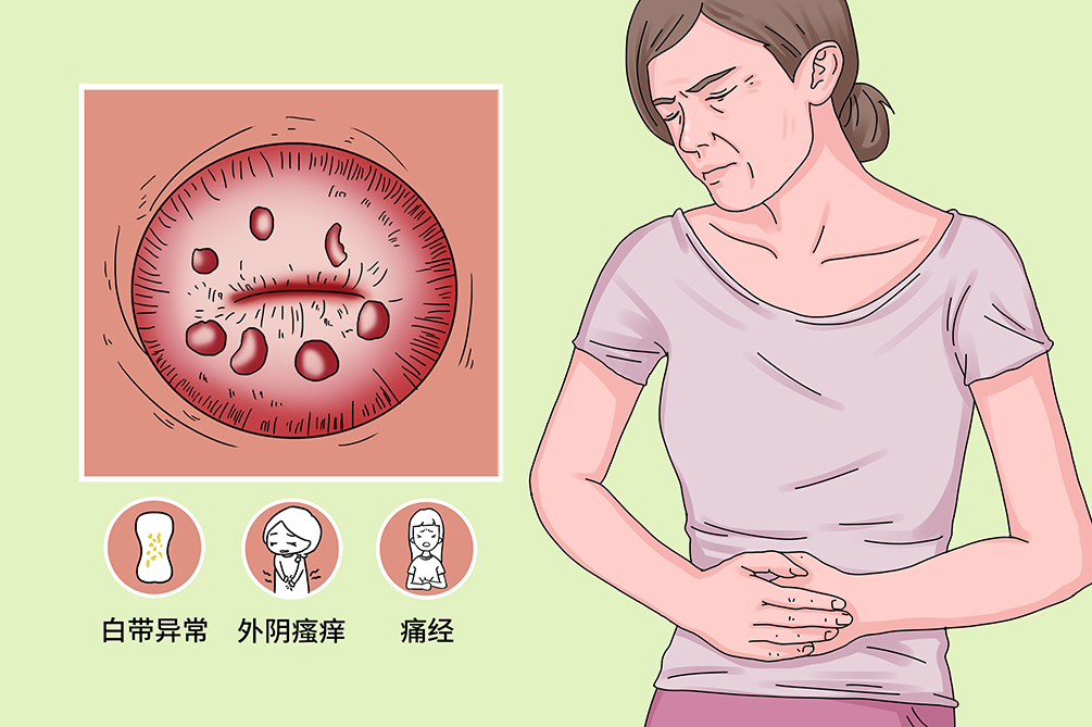 宫颈囊肿怎么治疗？权威解读及诊疗方案全解析