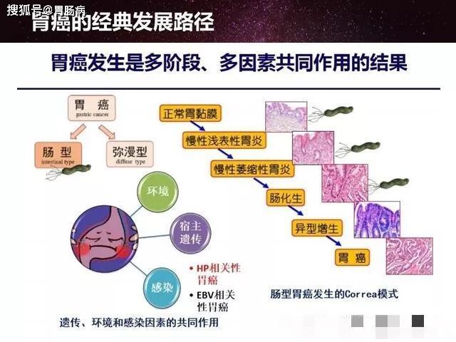 萎缩性胃炎是怎么回事？严重吗？深度解析及应对策略