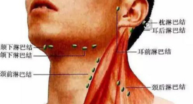 腋下淋巴结肿大是怎么回事？深度解析淋巴结肿大原因及应对策略