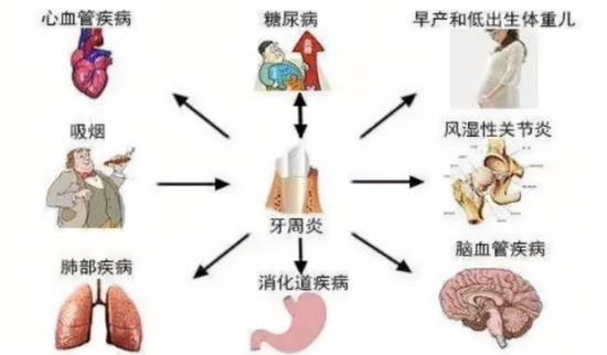 口臭是怎么回事？深度解析口臭成因、症状及治疗方法