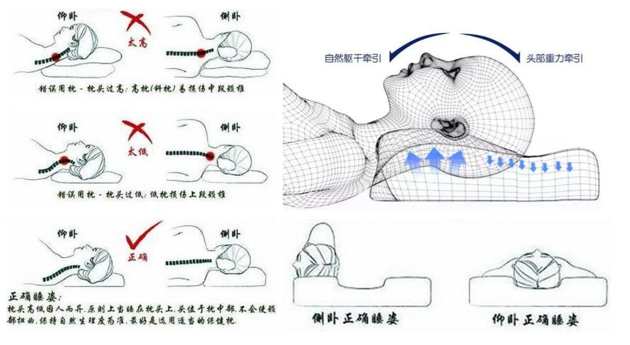 落枕是怎么回事？深度解析颈部肌肉损伤及预防方法