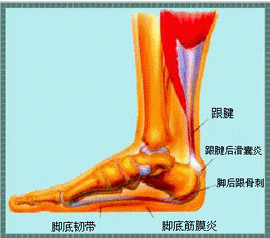 脚后跟疼是怎么回事？什么原因导致脚后跟疼痛？深度解析及应对方法