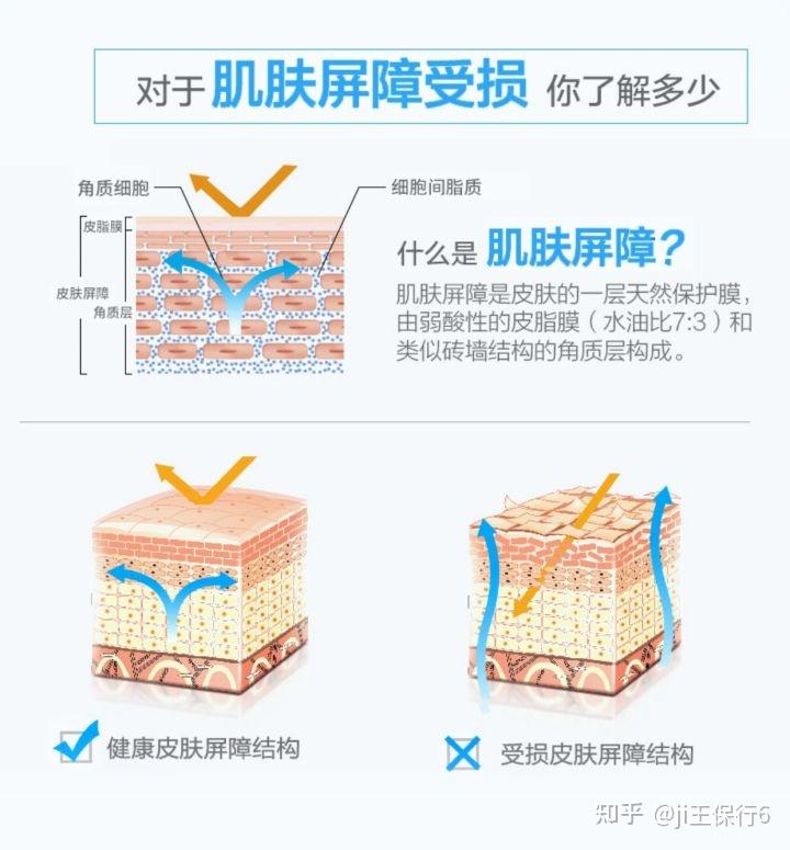 皮肤屏障受损怎么修复？深度解析及有效修复方案