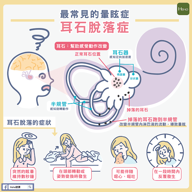 耳石症是怎么造成的？探秘耳石脱落与眩晕的成因