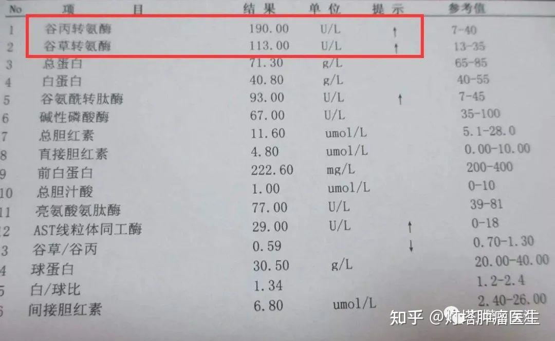 转氨酶高是怎么回事？深度解析转氨酶升高的原因、症状及应对策略