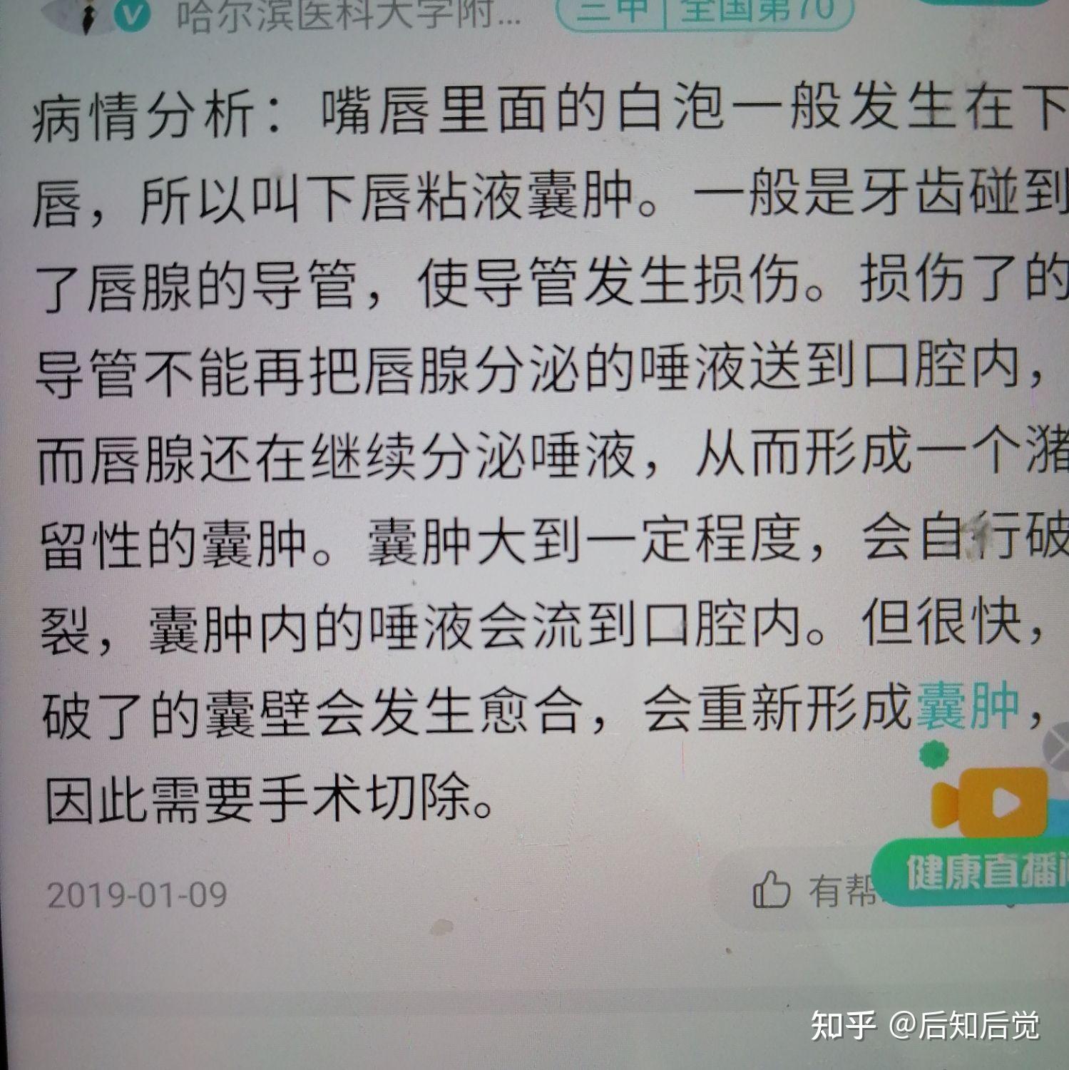 上火口上起泡快速消除方法：及时预防重视治疗