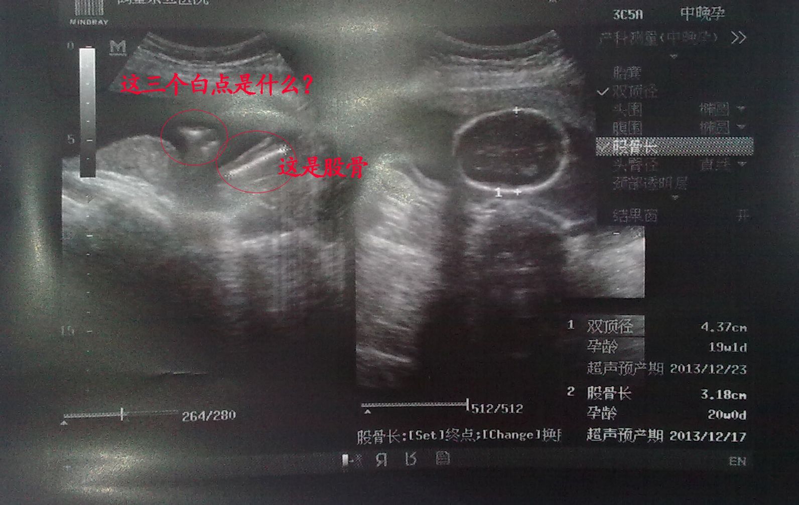 怀孕怎么看是男是女？民间偏方、科学方法及风险解读