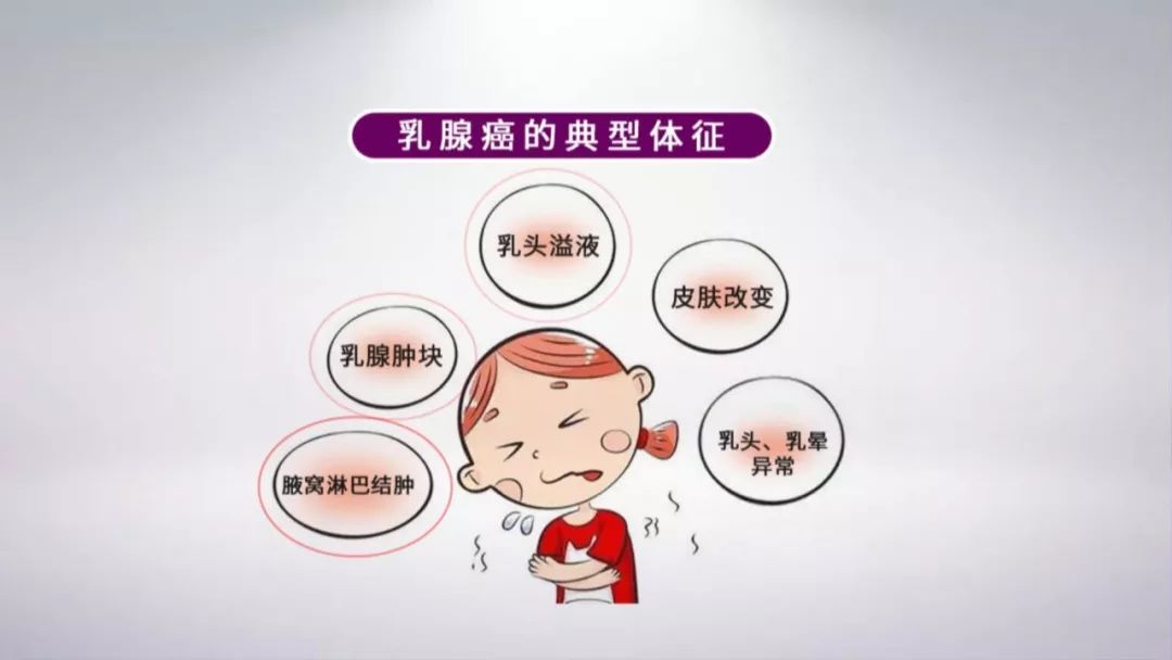 乳腺增生怎么治疗最好？权威解读及个性化方案