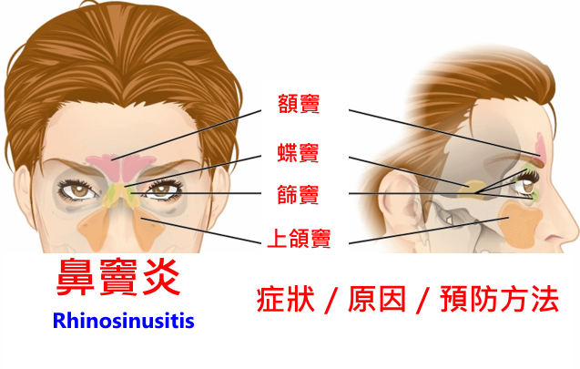 鼻涕一直流不停怎么办？快速缓解鼻塞流涕的实用指南