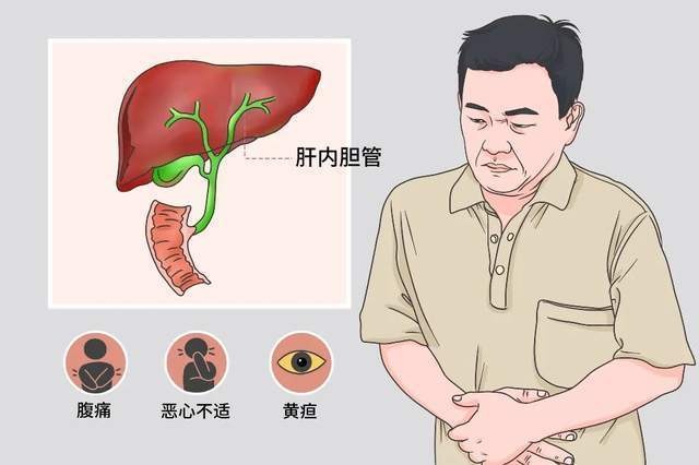 肝胆怎么调理？中医西医结合调理方案及注意事项