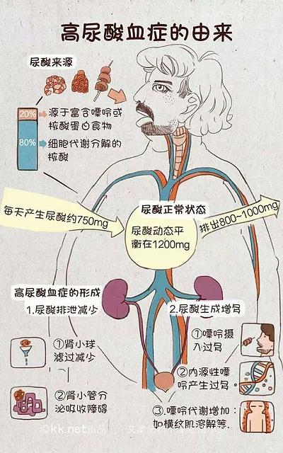 痛风怎么引起？深入探讨高尿酸血症及其他诱因