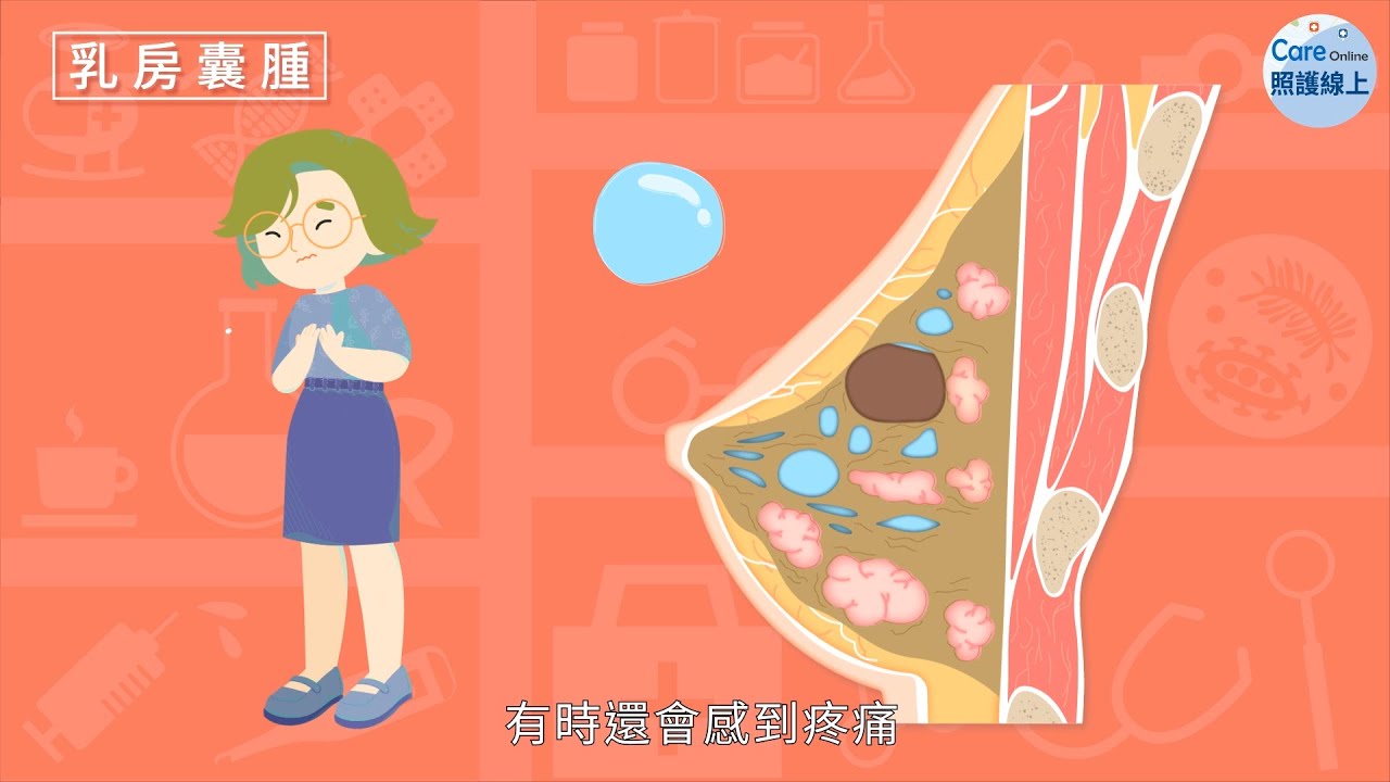 乳脂有硬块还疼怎么办？一览病因、诊断和有效的处理方法