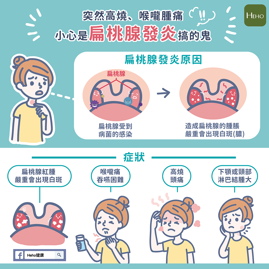 咽喉咳嗽怎么办？深度解析咳嗽类型及有效缓解方法