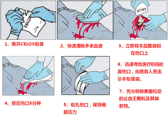 流鼻血怎么止血？家庭急救指南及常见原因深度解析