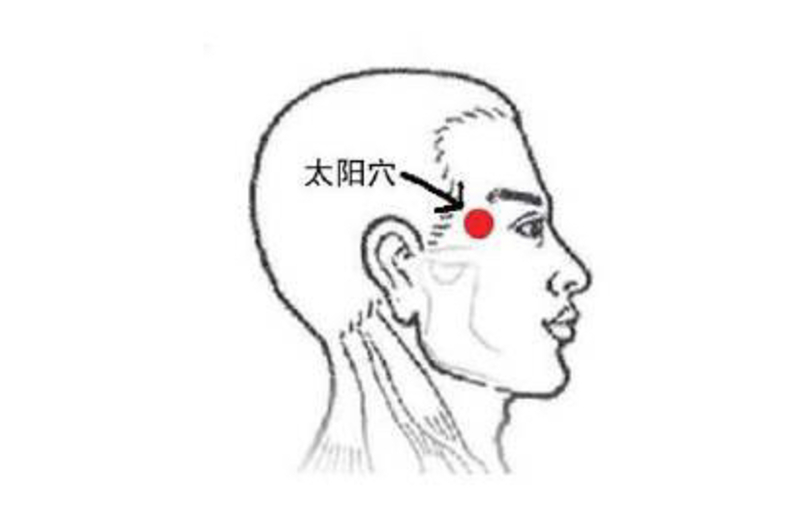 太阳穴痛怎么回事？深度解析常见原因及应对方法