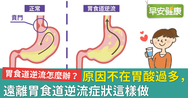 怎么判断婴儿是胃反流？深度解析婴儿胃食管反流症状及应对策略