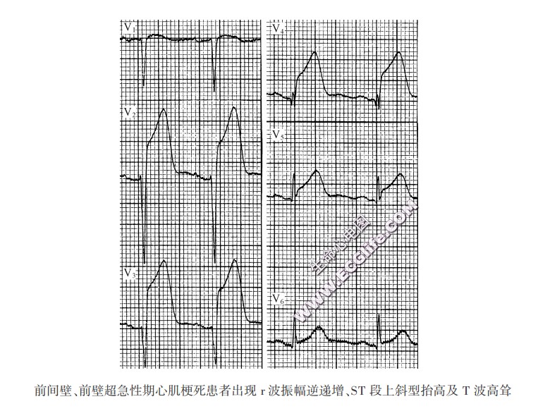 心脏T波改变怎么治疗？详解T波改变的病因、诊断及治疗方案