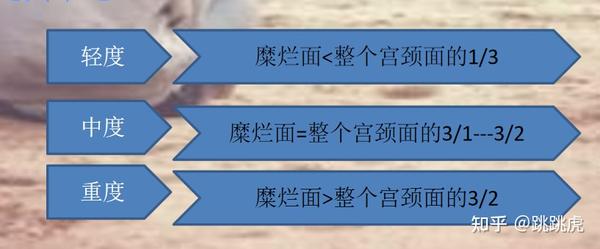 宫颈糜烂二度怎么治疗最好？权威解读及个性化方案