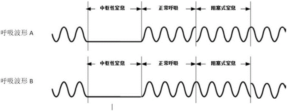 监护仪上的数据怎么看？解读生命体征的奥秘