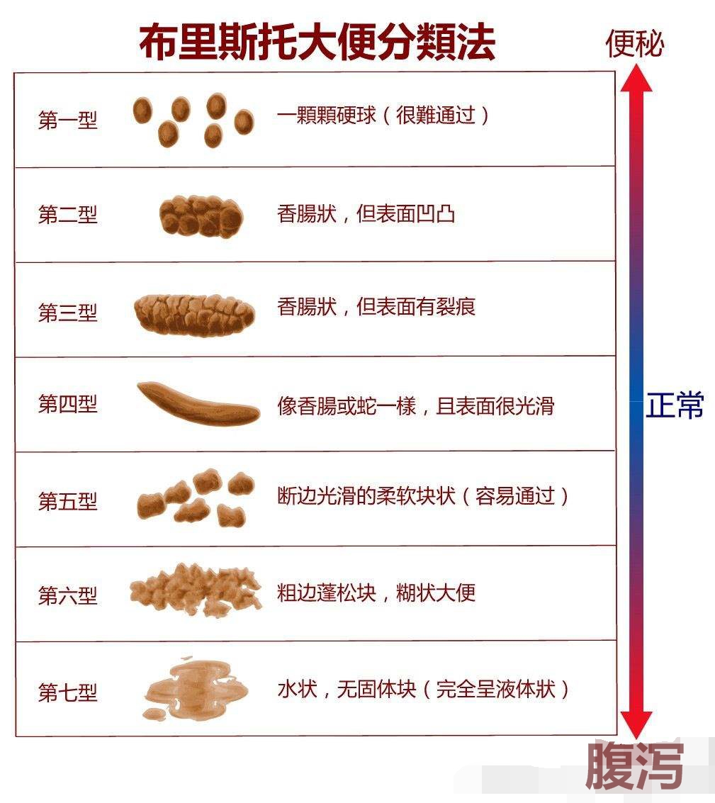 大便出血但不痛怎么回事？详解几种可能原因及应对方法