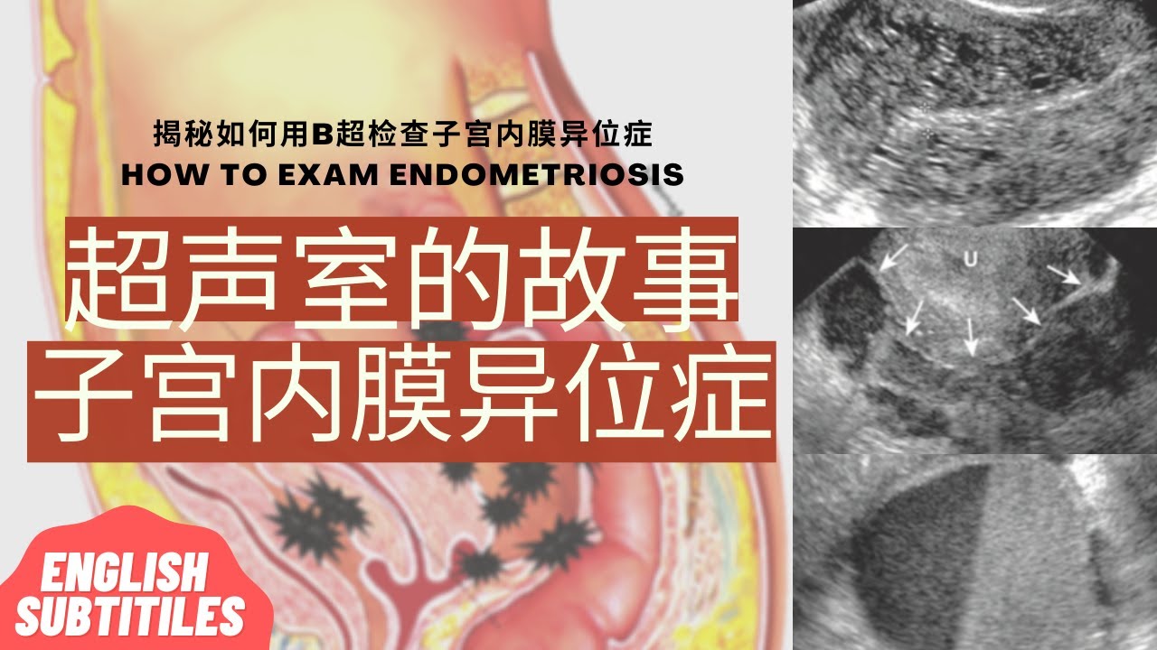 月经迟迟不干净怎么办？深度解析经期延长背后的原因及应对策略