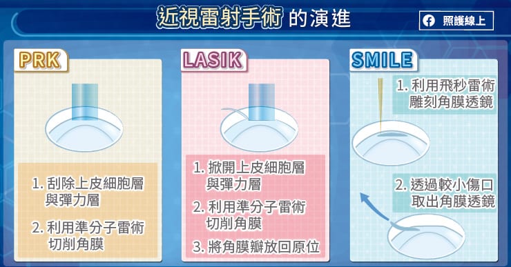 近视眼手术怎么做？详解术前检查、手术过程及术后护理