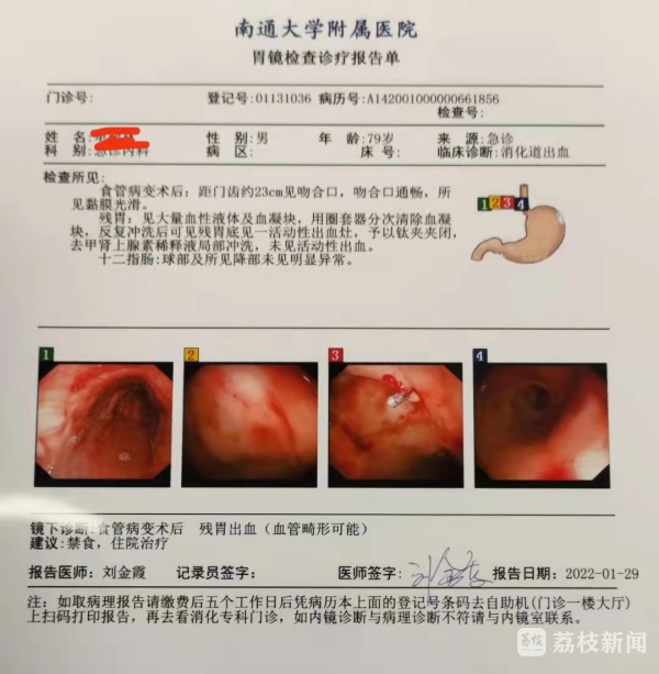 怎么判断自己胃出血？深度解析胃出血症状及鉴别诊断