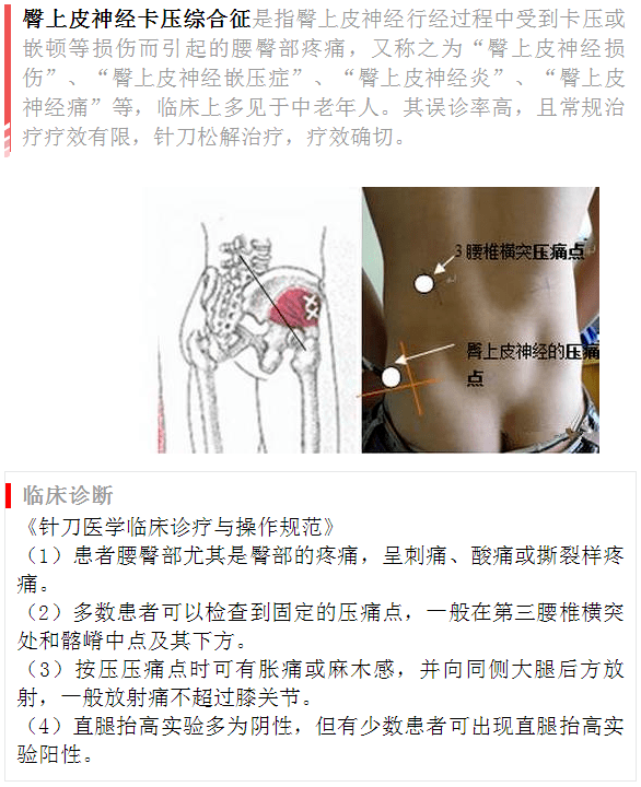 臀部一侧疼痛的原因及应对方法：全面解析常见病因与治疗策略