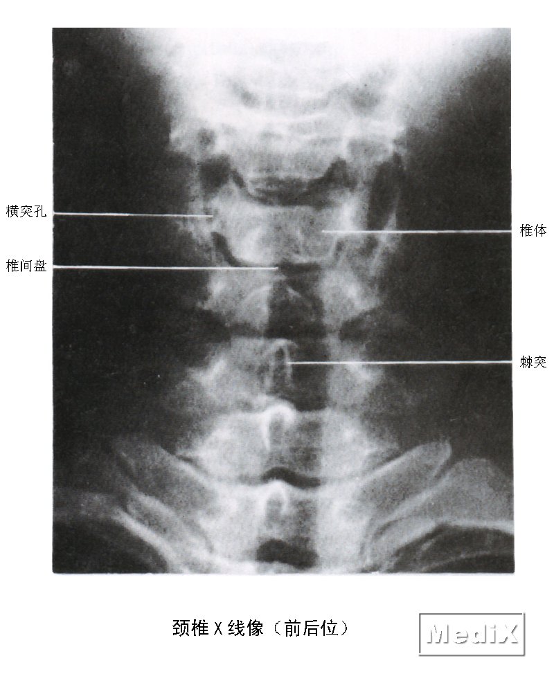 怎么检查颈椎？从症状自查到专业诊断全方位解读