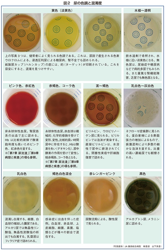 一直尿怎么回事？排尿异常的常见原因及应对策略