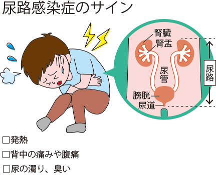 尿检白细胞高是怎么回事？深度解析尿液检查异常及应对策略