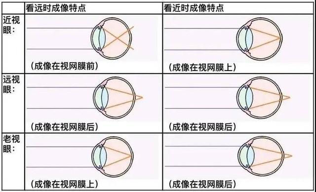 老花镜怎么选？一份详尽的选购指南，助您轻松应对老视难题