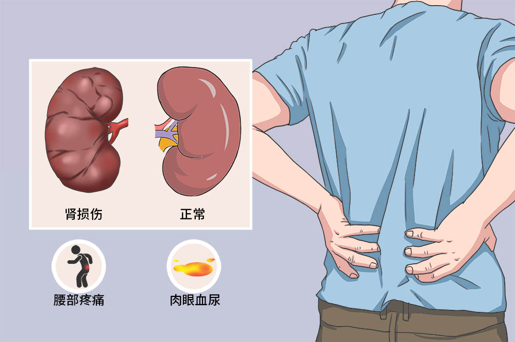 肾亏怎么调理？中医西医结合方案，助您重拾健康活力