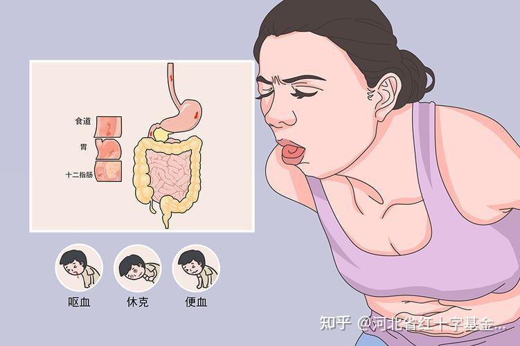 大便黑色是怎么回事？详解黑色大便的常见原因、危险信号及应对方法