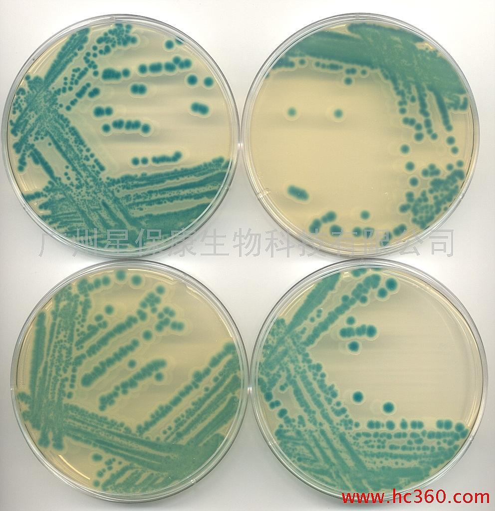 孕妇感染李斯特菌如何确认？症状、检查及预防措施详解