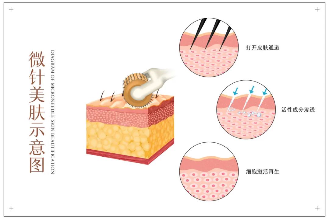 妊娠纹怎么消除？有效方法、风险及未来展望