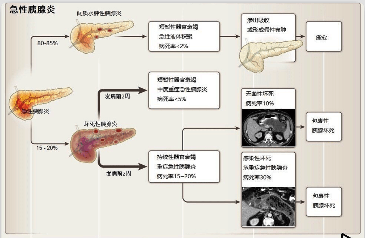 胰腺炎怎么治疗？详解急性胰腺炎和慢性胰腺炎的治疗方法及预防措施