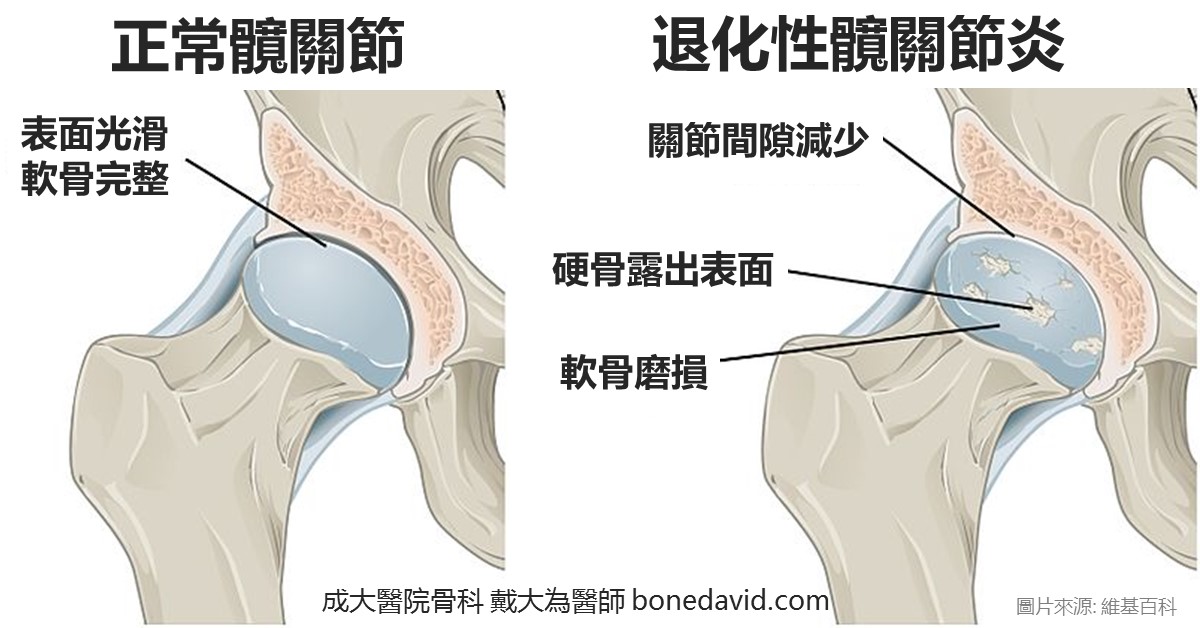 大腿肉疼是怎么回事？探究常见原因及应对方法