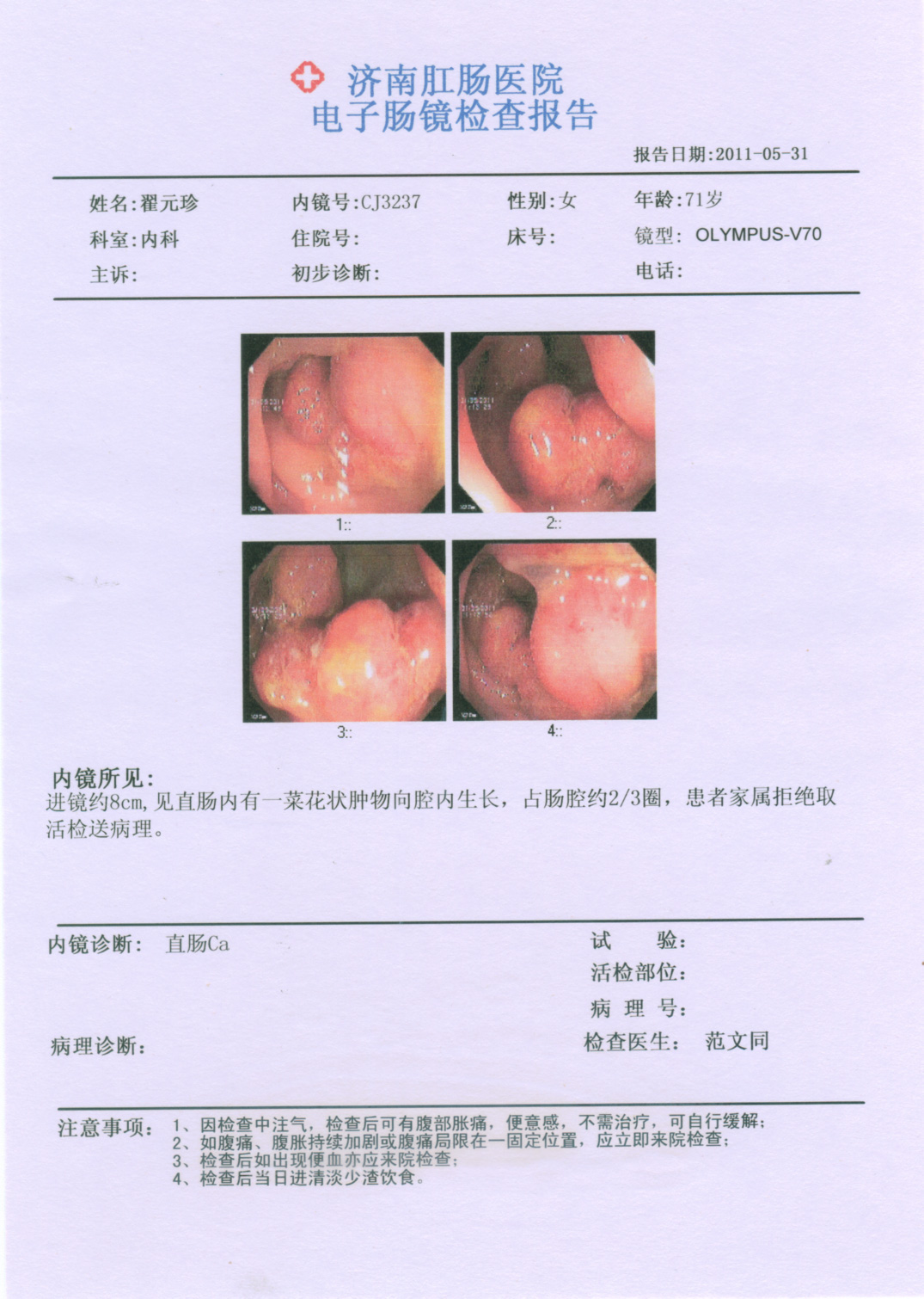 检查痔疮怎么检查？专业医生详解各种检查方法及注意事项