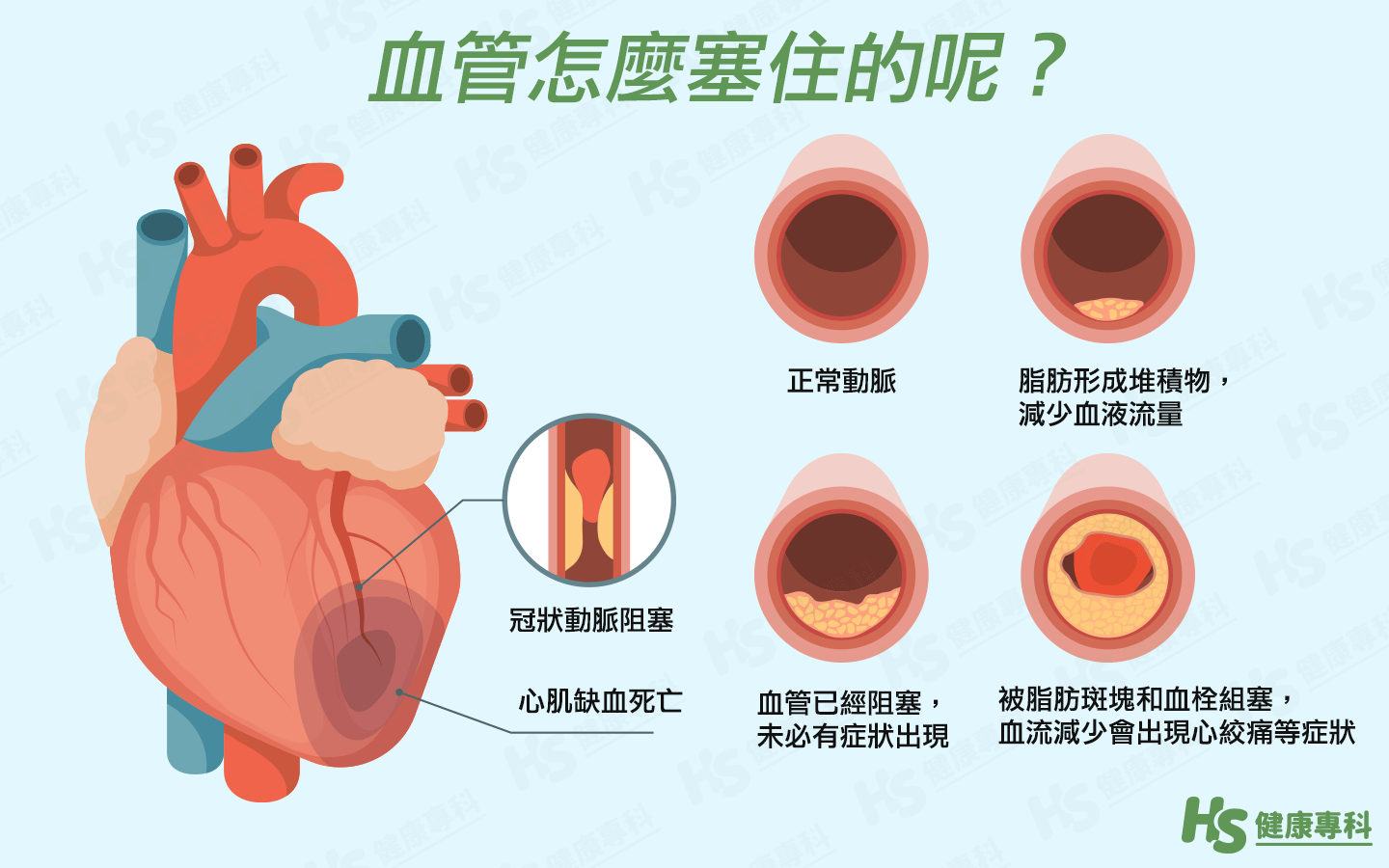 胸前疼痛是怎么回事？深度解析常见原因及应对方法